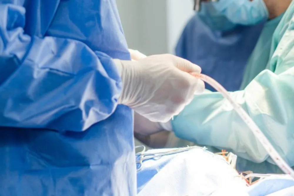 Manejo medico y quirúrgico de abscesos